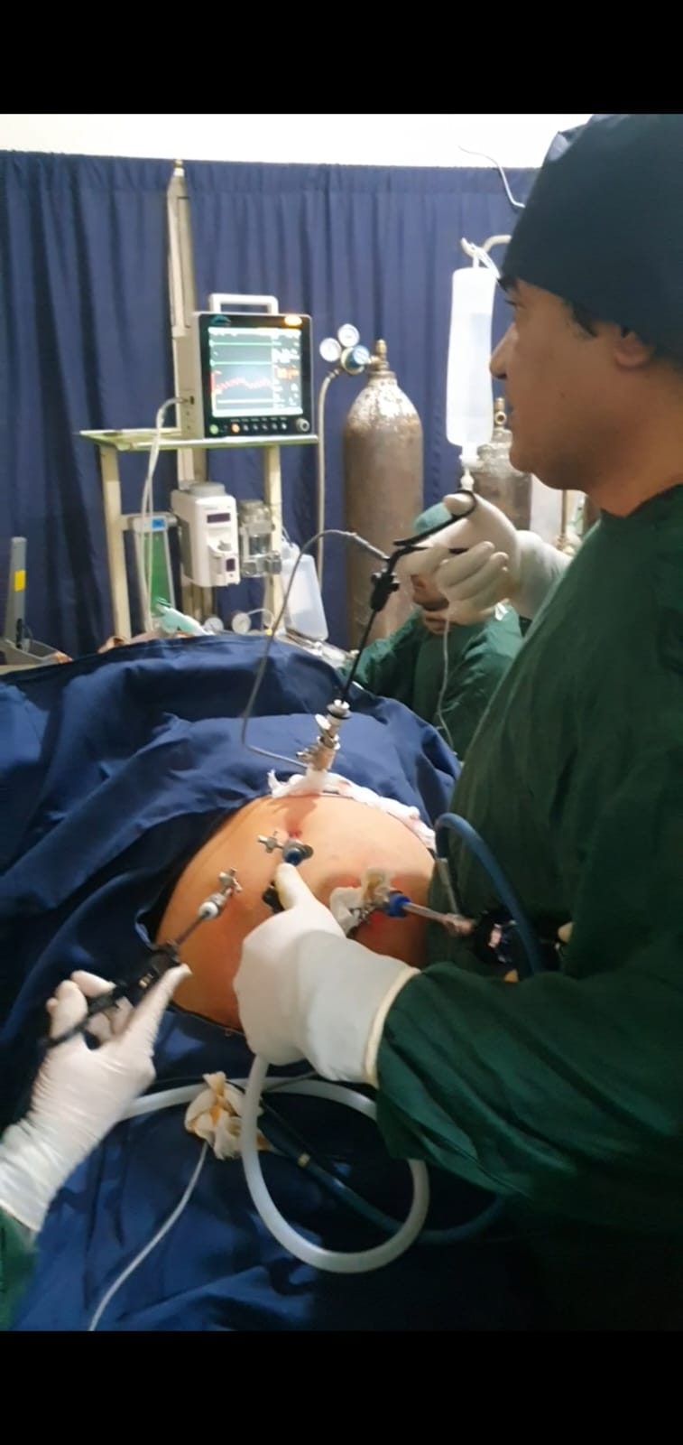 Surgeon carefully placing laparoscopic instruments during an operation